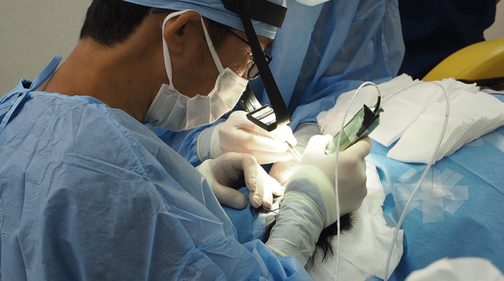 手術の写真 - Dr.成井の毛髪LAB – AGA対策から植毛最新技術まで